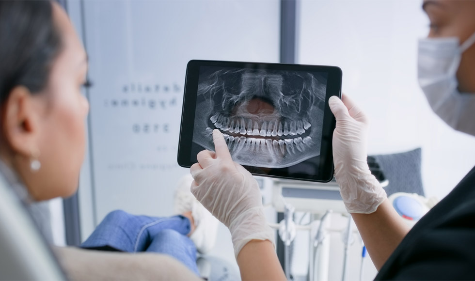 root-canal-treatment-needed-img